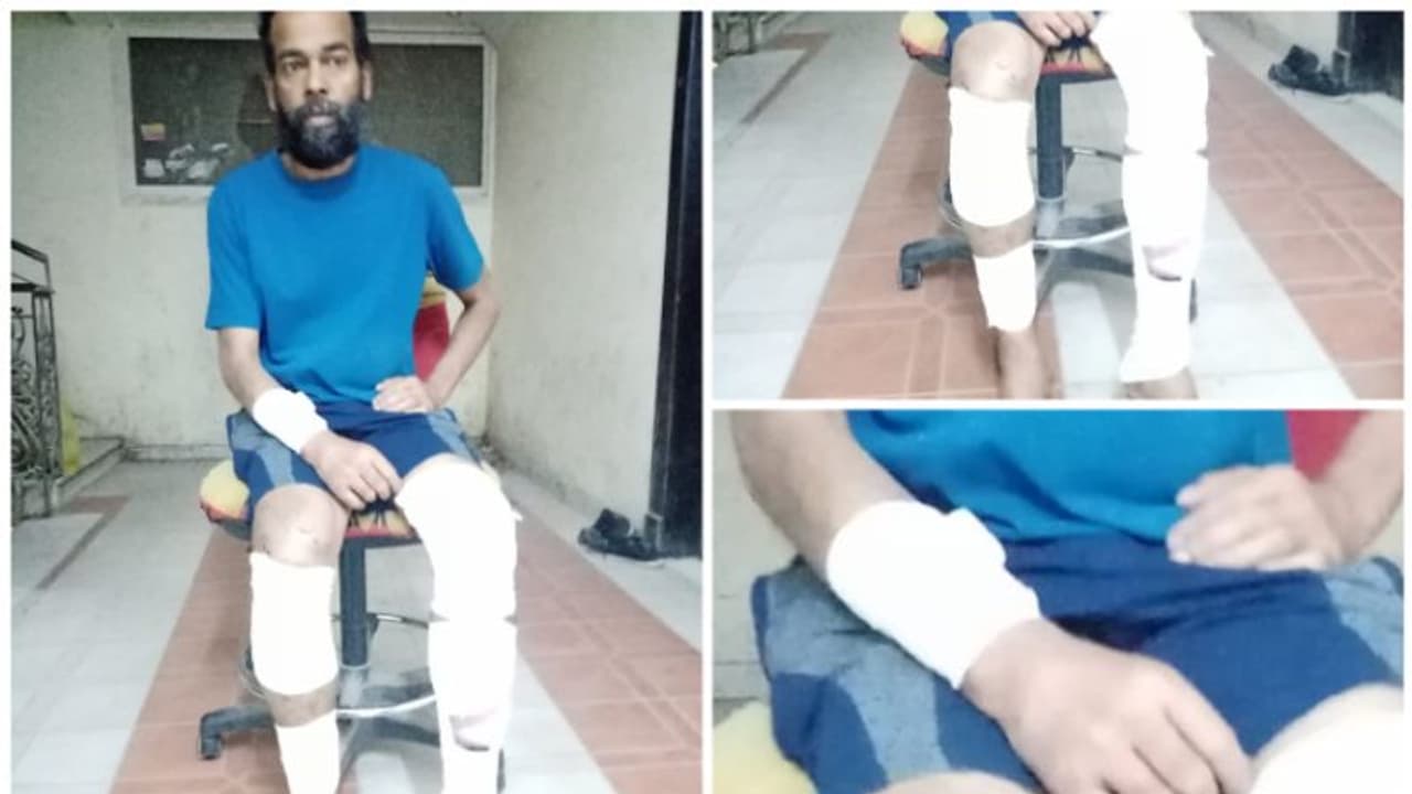 ജോലി കഴിഞ്ഞ് മടങ്ങുന്നതിനിടെ മോഷ്ടാക്കളുടെ ആക്രമണം; പ്രവാസി മലയാളിക്ക് ഗുരുതര പരിക്ക് ജോലി കഴിഞ്ഞ് മടങ്ങുന്നതിനിടെ മോഷ്ടാക്കളുടെ ആക്രമണം; പ്രവാസി മലയാളിക്ക് ഗുരുതര പരിക്ക്