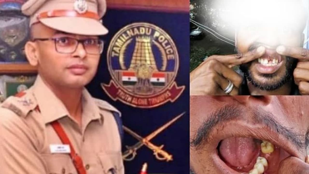 பல் பிடுங்கிய விவகாரத்தில் பல்வீர் சிங் மீது வழக்கு பதிவு.! கடுமையான தண்டனை வழங்கிடுக கே.பாலகிருஷ்ணன்