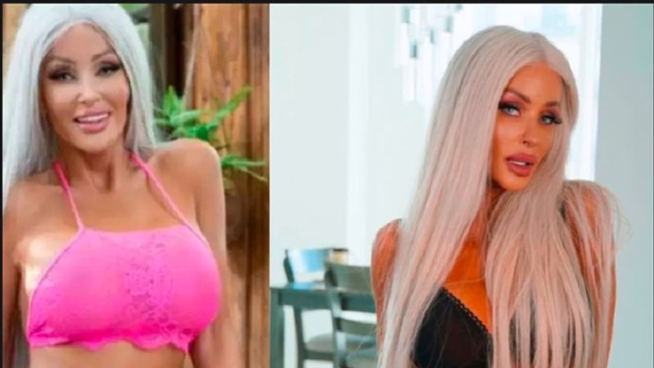 3.5 ಕೋಟಿ ವ್ಯಯಿಸಿ ಬಾರ್ಬಿ ಡಾಲ್‌ ಆಗಿದ್ದಾಕೆಗೆ ಈಗ ತಿನ್ನಲು ಕೂಳಿಲ್ಲ...