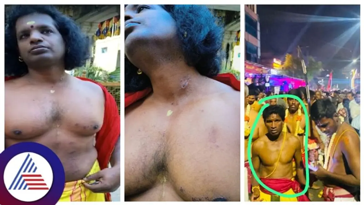 ಬೆಂಗಳೂರು ಕರಗ ಮಹೋತ್ಸವಕ್ಕೆ ಕೆಮಿಕಲ್ ಮಿಶ್ರಿತ ಹೂವು ಪೂರೈಕೆ: ಕರಗ ಹೊತ್ತ ಜ್ಞಾನೇಂದ್ರ ದೇಹದಲ್ಲಿ ಸುಟ್ಟ ಗಾಯ ಬೆಂಗಳೂರು ಕರಗ ಮಹೋತ್ಸವಕ್ಕೆ ಕೆಮಿಕಲ್ ಮಿಶ್ರಿತ ಹೂವು ಪೂರೈಕೆ: ಕರಗ ಹೊತ್ತ ಜ್ಞಾನೇಂದ್ರ ದೇಹದಲ್ಲಿ ಸುಟ್ಟ ಗಾಯ