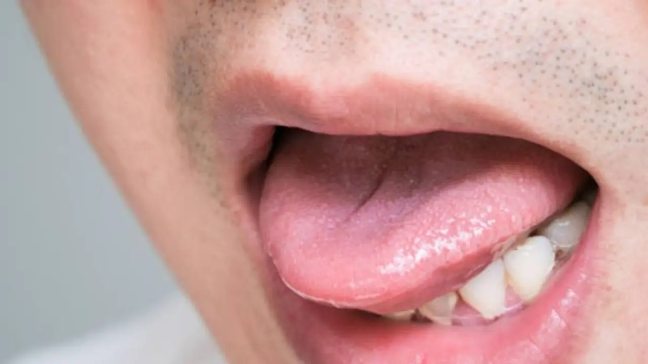 Andhra Pradesh: ఇష్టం లేకుండా ముద్దు పెట్టడానికి వచ్చాడని భర్త నాలుక కొరికేసిన భార్య Andhra Pradesh: ఇష్టం లేకుండా ముద్దు పెట్టడానికి వచ్చాడని భర్త నాలుక కొరికేసిన భార్య