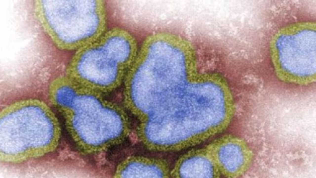 Health Tips: എന്താണ് H3N8 വൈറസ്? തിരിച്ചറിയാം ഈ ലക്ഷണങ്ങളെ... Health Tips: എന്താണ് H3N8 വൈറസ്? തിരിച്ചറിയാം ഈ ലക്ഷണങ്ങളെ...