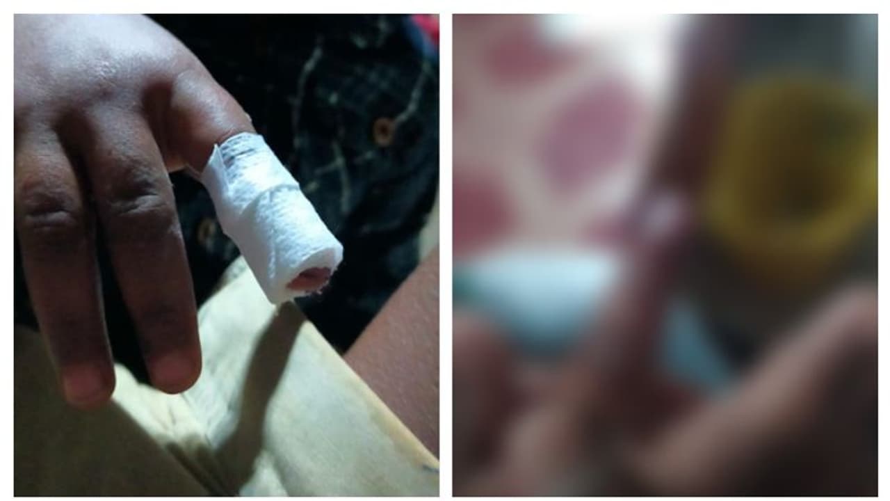 വിരലിന് മുറിവ് പറ്റിയ കുട്ടിയെ മെഡിക്കൽ കോളേജിലേക്ക് റെഫർ ചെയ്ത സംഭവം; ഡോക്ടർക്ക് പിഴവെന്ന് റിപ്പോർട്ട് വിരലിന് മുറിവ് പറ്റിയ കുട്ടിയെ മെഡിക്കൽ കോളേജിലേക്ക് റെഫർ ചെയ്ത സംഭവം; ഡോക്ടർക്ക് പിഴവെന്ന് റിപ്പോർട്ട്