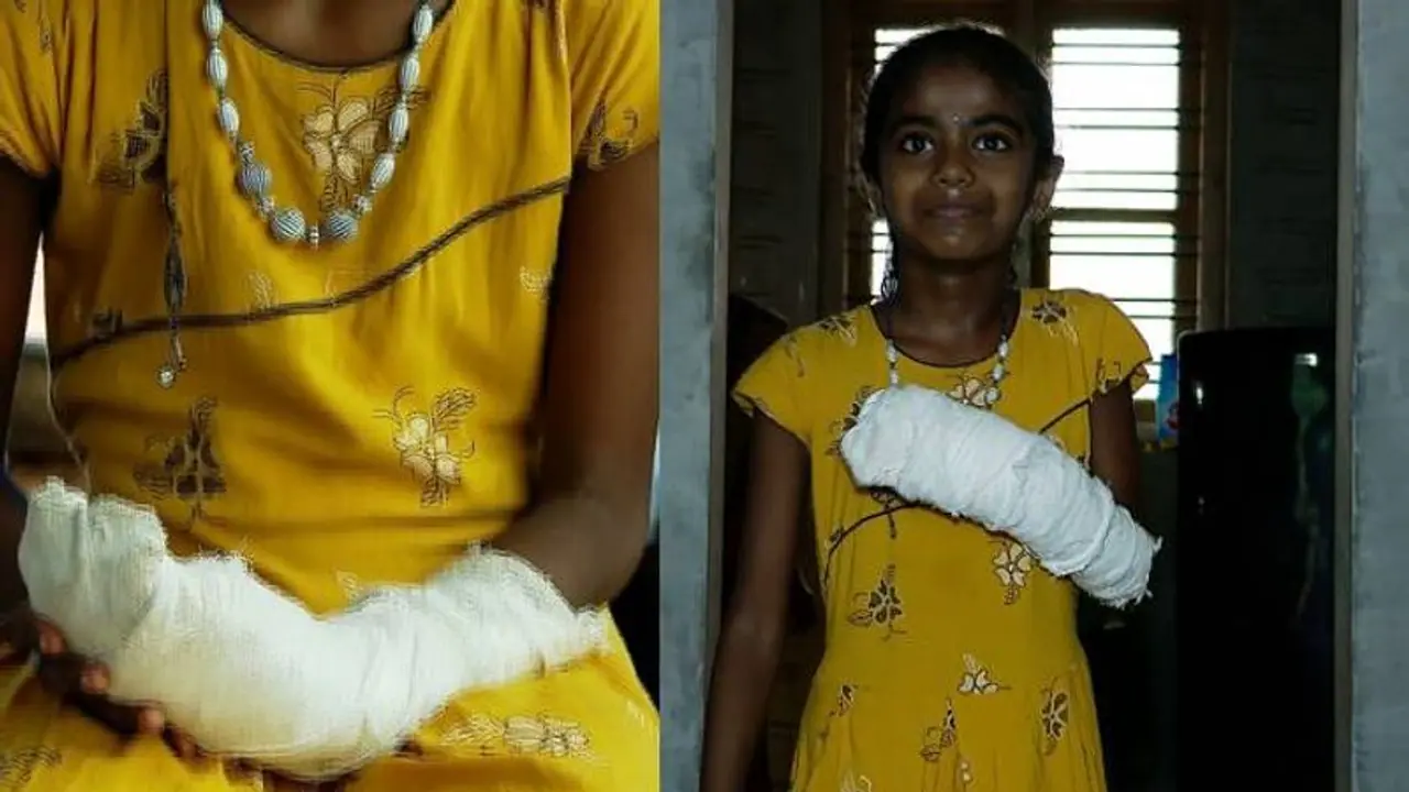 Kerala girl loses finger mobility due to doctor's negligence; Case registered Kerala girl loses finger mobility due to doctor's negligence; Case registered