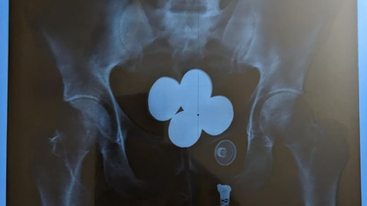 സ്വർണക്കടത്ത്: വിമാനത്താവളത്തിൽ കസ്റ്റംസിനെ വെട്ടിച്ചു; പുറത്ത് കടന്നപ്പോൾ പൊലീസ് 'പൊക്കി' സ്വർണക്കടത്ത്: വിമാനത്താവളത്തിൽ കസ്റ്റംസിനെ വെട്ടിച്ചു; പുറത്ത് കടന്നപ്പോൾ പൊലീസ് 'പൊക്കി'