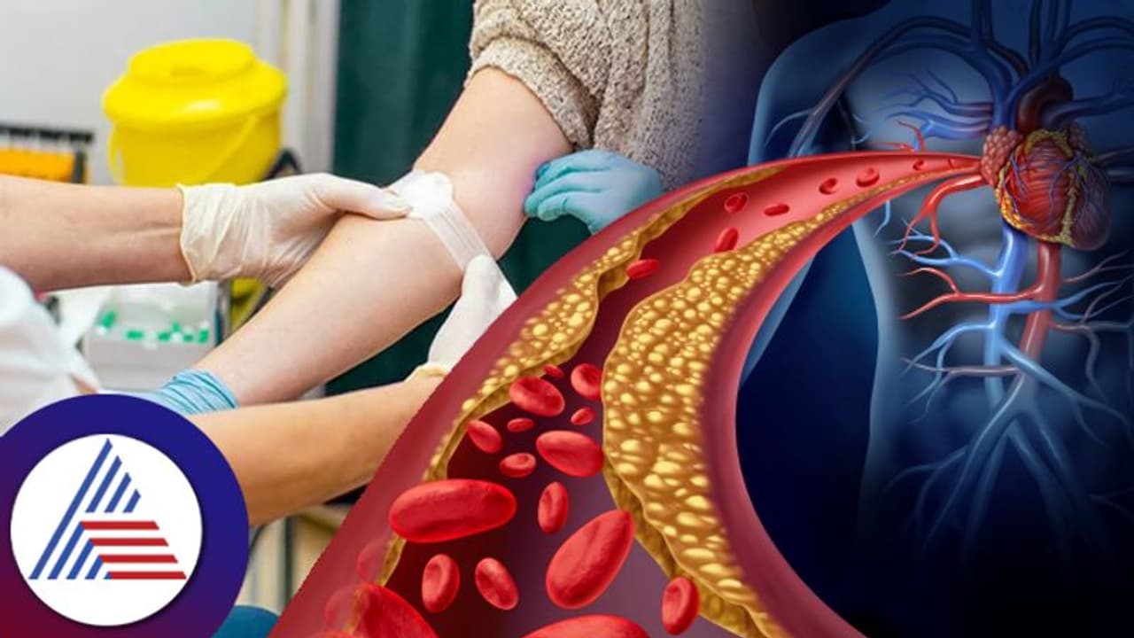 ಬ್ಯಾಡ್ ಕೊಲೆಸ್ಟ್ರಾಲ್ ಇದ್ರೆ ಡೇಂಜರ್, ನಿಮ್ಮ ರಕ್ತದಲ್ಲಿದು ಇದೆಯಾ ಚೆಕ್ ಮಾಡ್ಕೊಳ್ಳಿ! ಬ್ಯಾಡ್ ಕೊಲೆಸ್ಟ್ರಾಲ್ ಇದ್ರೆ ಡೇಂಜರ್, ನಿಮ್ಮ ರಕ್ತದಲ್ಲಿದು ಇದೆಯಾ ಚೆಕ್ ಮಾಡ್ಕೊಳ್ಳಿ!