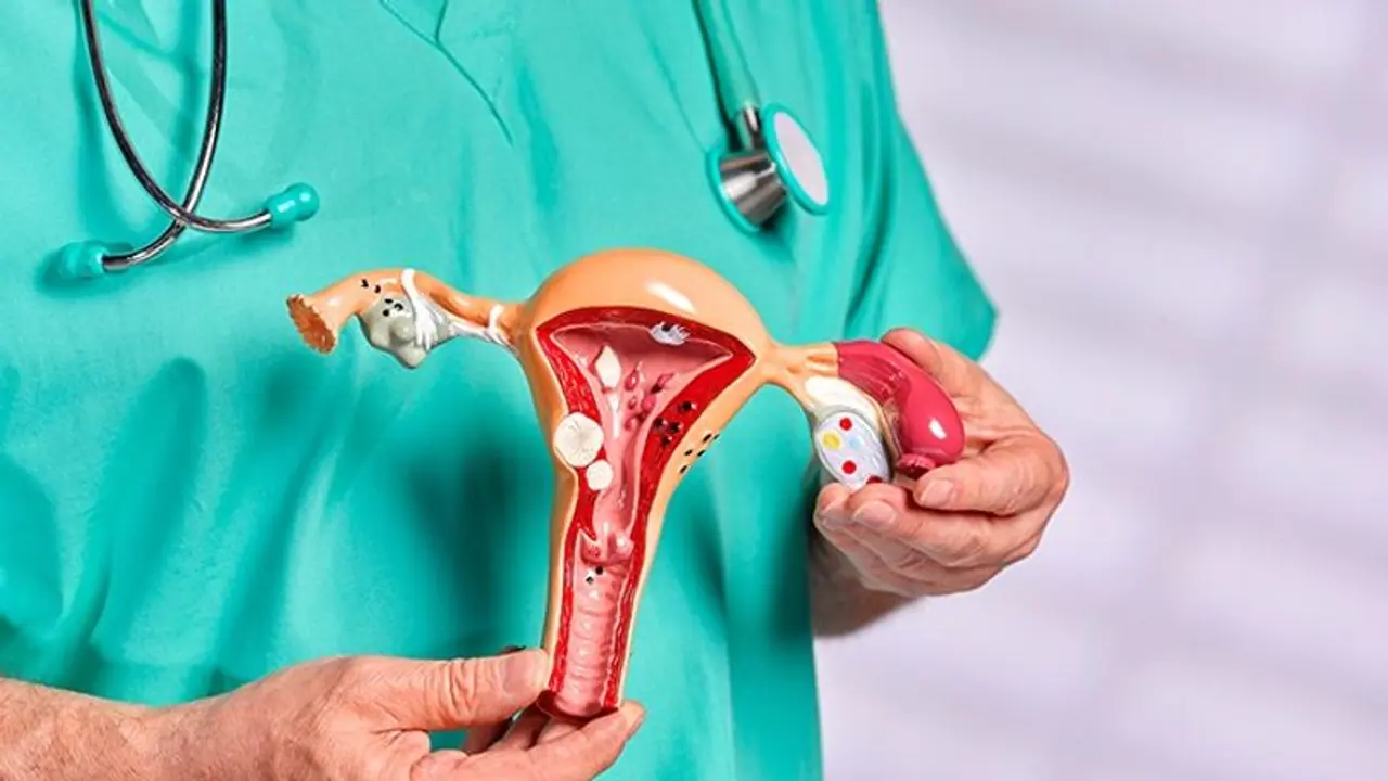 From leafy greens vegetables to Probiotics 6, food items to have healthy uterus From leafy greens vegetables to Probiotics 6, food items to have healthy uterus