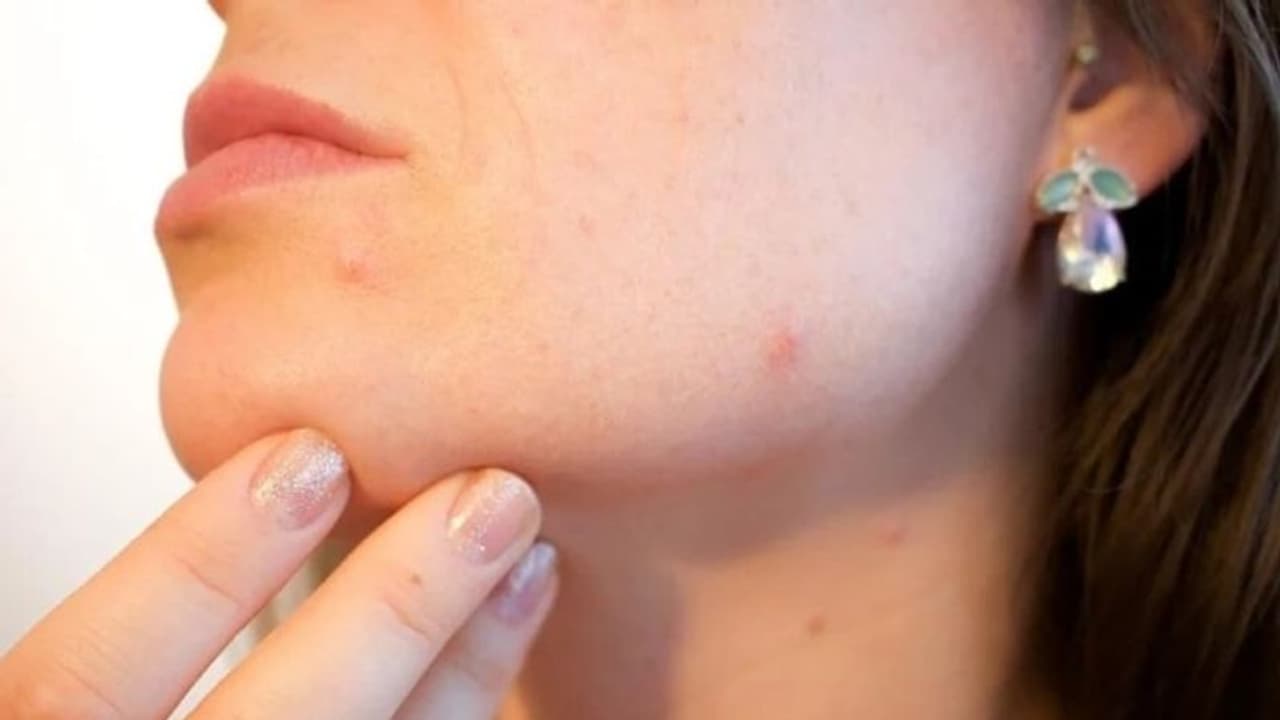 കൊളസ്ട്രോള് കൂടുതലായാല് അത് മുഖത്ത് അറിയാം; എങ്ങനെയെന്ന് മനസിലാക്കൂ... കൊളസ്ട്രോള് കൂടുതലായാല് അത് മുഖത്ത് അറിയാം; എങ്ങനെയെന്ന് മനസിലാക്കൂ...