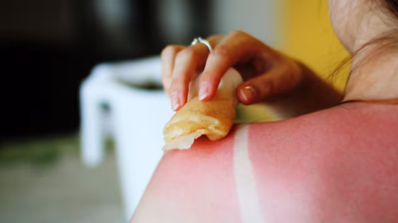 സൂര്യാഘാതം; എങ്ങനെ തിരിച്ചറിയാം? ശ്രദ്ധിക്കേണ്ട കാര്യങ്ങള്‍... 