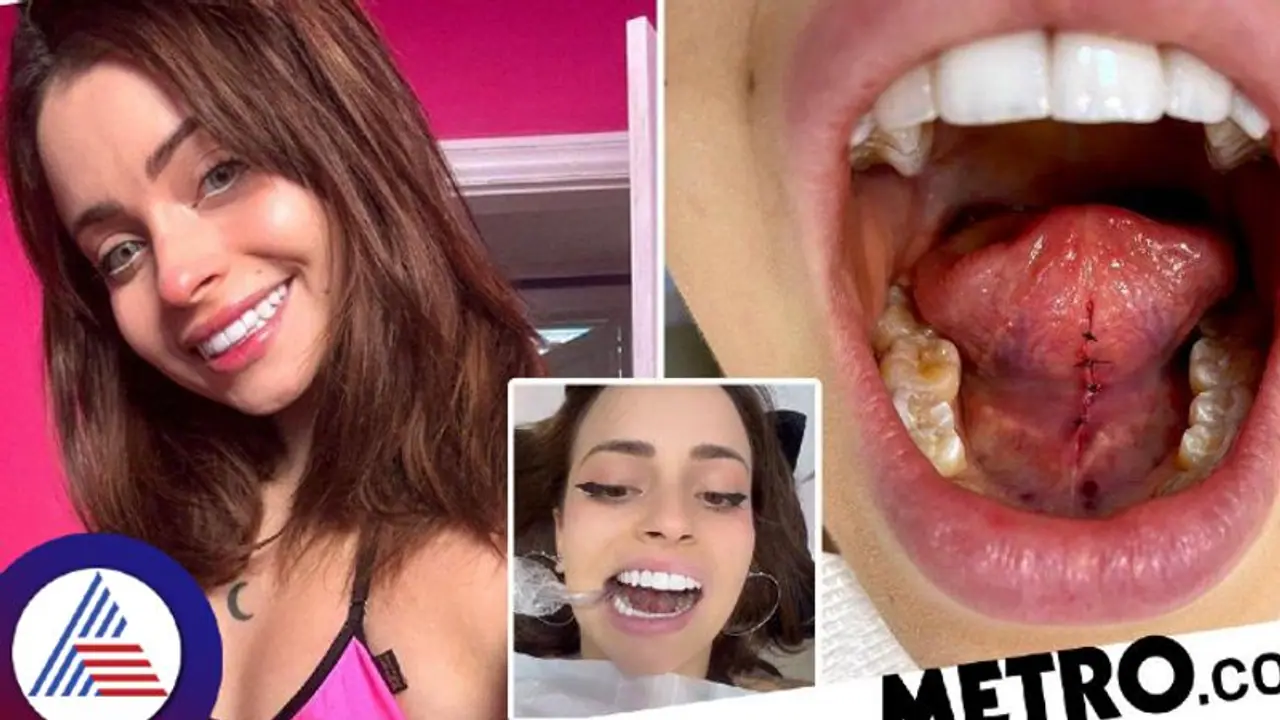 ಅಬ್ಬಬ್ಬಾ..ಸರಿಯಾಗಿ ಕಿಸ್ ಮಾಡೋಕಾಗಲ್ಲಾಂತ ನಾಲಿಗೆ ಕತ್ತರಿಸಿಕೊಂಡ ಯುವತಿ! ಅಬ್ಬಬ್ಬಾ..ಸರಿಯಾಗಿ ಕಿಸ್ ಮಾಡೋಕಾಗಲ್ಲಾಂತ ನಾಲಿಗೆ ಕತ್ತರಿಸಿಕೊಂಡ ಯುವತಿ!