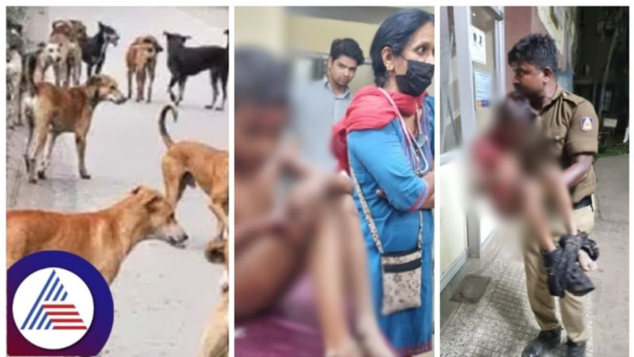 ನಮಾಜ್ಗೆ ಹೋಗುತ್ತಿದ್ದ ಬಾಲಕನ ಮೇಲೆ 15 ನಾಯಿಗಳು ದಾಳಿ: ಸಾವು ಬುದುಕಿನ ನಡುವೆ ಹೋರಾಟ ನಮಾಜ್ಗೆ ಹೋಗುತ್ತಿದ್ದ ಬಾಲಕನ ಮೇಲೆ 15 ನಾಯಿಗಳು ದಾಳಿ: ಸಾವು ಬುದುಕಿನ ನಡುವೆ ಹೋರಾಟ