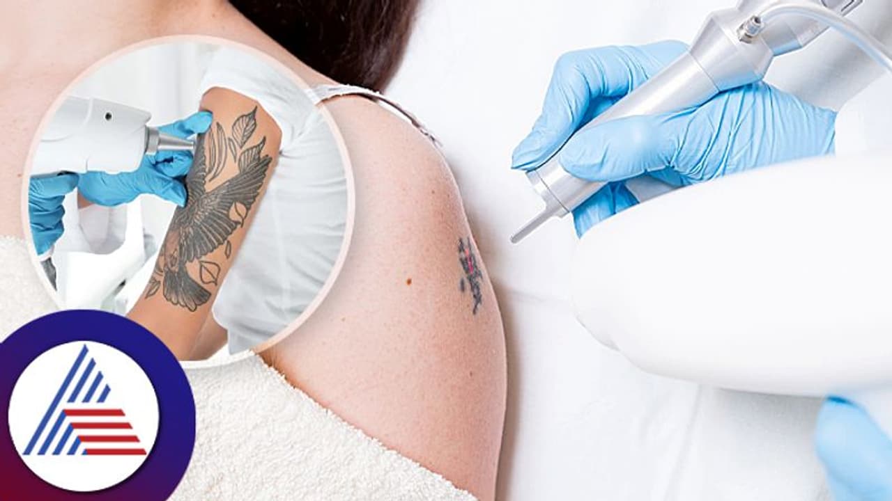 Permanent Tattoo: ಶಾಶ್ವತ ಟ್ಯಾಟೂಗೆ ಗುಡ್ ಬೈ ಹೇಳೋದು ಹೀಗೆ