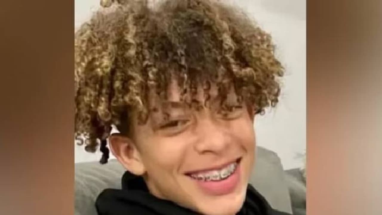 ടിക്ടോക്കിൽ ചലഞ്ച്, സ്ഫോടനം, 16 കാരന് 80% പൊള്ളൽ, മോനെ കണ്ടാൽ തിരിച്ചറിയാനാകുന്നില്ലെന്ന് അമ്മ