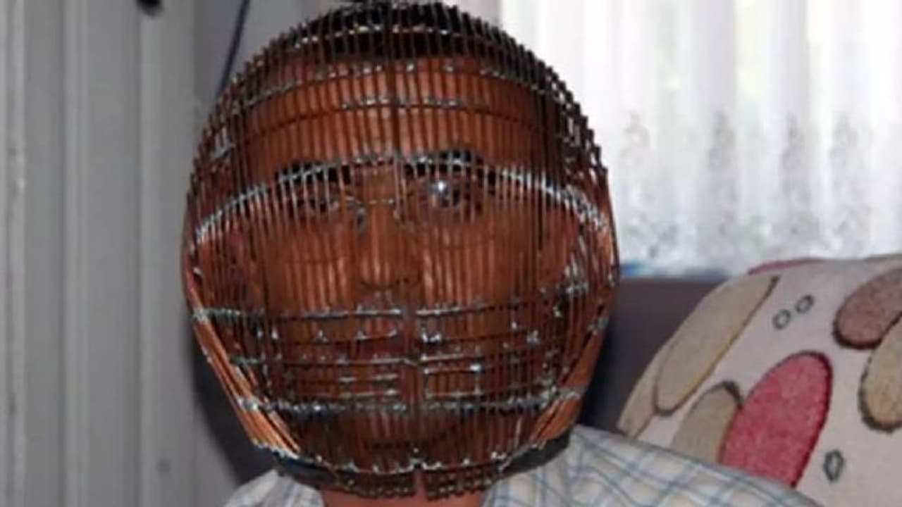 പുകവലിയിൽ നിന്നും രക്ഷപ്പെടാൻ സ്വന്തം തല കൂട്ടിലടച്ച മനുഷ്യൻ! സത്യം ഇതാണ് പുകവലിയിൽ നിന്നും രക്ഷപ്പെടാൻ സ്വന്തം തല കൂട്ടിലടച്ച മനുഷ്യൻ! സത്യം ഇതാണ്