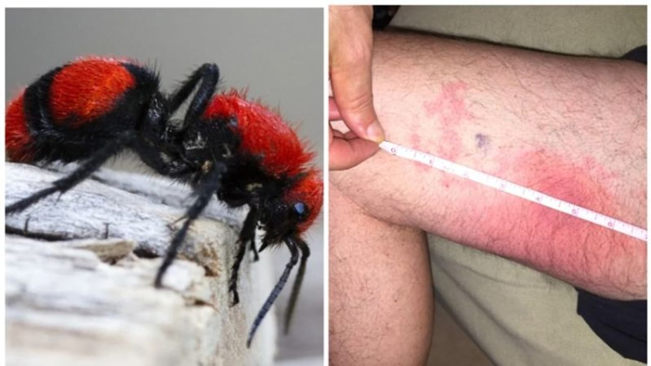 'പശു കൊലയാളി' ഉറുമ്പ് കടിച്ച അനുഭവം പങ്കുവച്ച് ഒരു വൈറല് കുറിപ്പ് 'പശു കൊലയാളി' ഉറുമ്പ് കടിച്ച അനുഭവം പങ്കുവച്ച് ഒരു വൈറല് കുറിപ്പ്