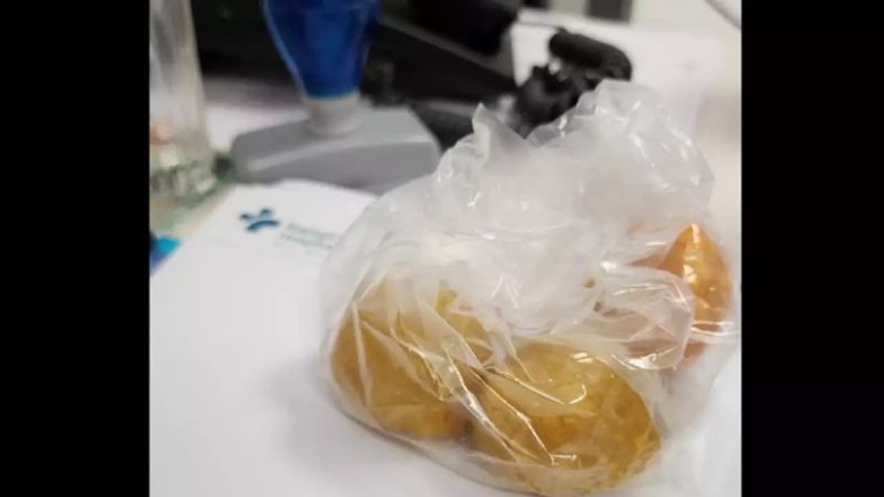 'ആ നാലാമത്തെ ലഡു'; മരിച്ചുപോയ രോഗിയെ കുറിച്ച് ഹൃദയസ്പര്ശിയായ കുറിപ്പുമായി ഡോക്ടര് 'ആ നാലാമത്തെ ലഡു'; മരിച്ചുപോയ രോഗിയെ കുറിച്ച് ഹൃദയസ്പര്ശിയായ കുറിപ്പുമായി ഡോക്ടര്