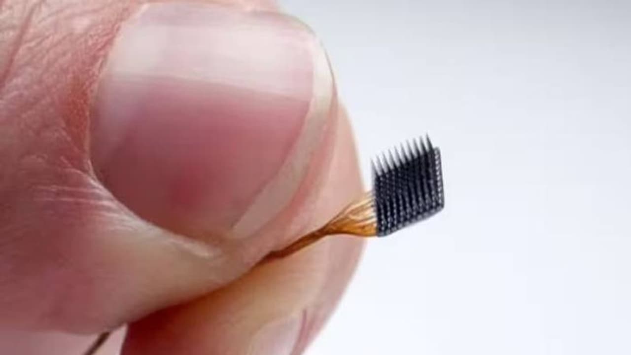 അന്ധതയും പക്ഷാഘാതവും നേരിടാൻ ആളുകളുടെ തലച്ചോറിൽ ചിപ്പുകളുമായി അമേരിക്കൻ കമ്പനി അന്ധതയും പക്ഷാഘാതവും നേരിടാൻ ആളുകളുടെ തലച്ചോറിൽ ചിപ്പുകളുമായി അമേരിക്കൻ കമ്പനി