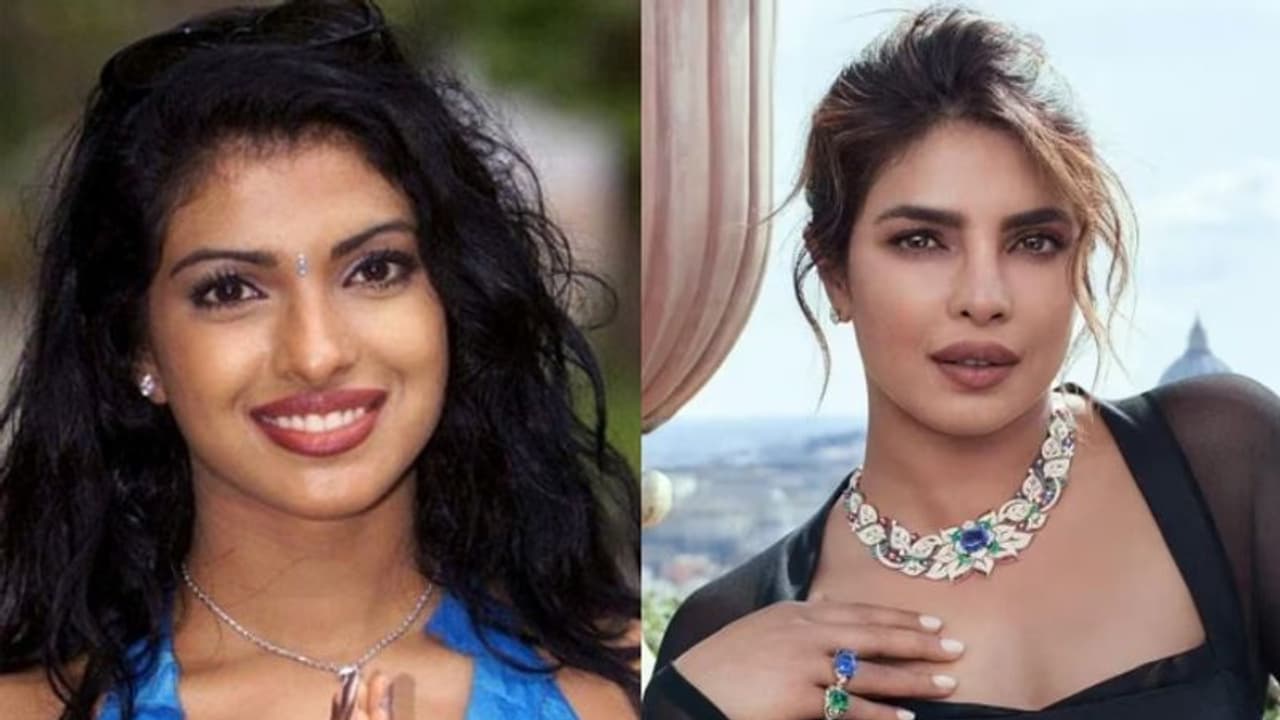 മൂക്കിന്റെ ശസ്ത്രക്രിയയ്ക്ക് ശേഷം കടുത്ത വിഷാദത്തിലേക്ക് പോകാൻ കാരണം: പ്രിയങ്ക ചോപ്ര പറയുന്നു... മൂക്കിന്റെ ശസ്ത്രക്രിയയ്ക്ക് ശേഷം കടുത്ത വിഷാദത്തിലേക്ക് പോകാൻ കാരണം: പ്രിയങ്ക ചോപ്ര പറയുന്നു...