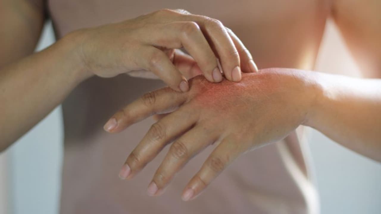 Health Tips: ചർമ്മത്തിൽ ഈ ലക്ഷണങ്ങൾ കണ്ടാൽ നിസാരമായി കാണരുത്, അറിയാം ഈ രോഗത്തെ... Health Tips: ചർമ്മത്തിൽ ഈ ലക്ഷണങ്ങൾ കണ്ടാൽ നിസാരമായി കാണരുത്, അറിയാം ഈ രോഗത്തെ...