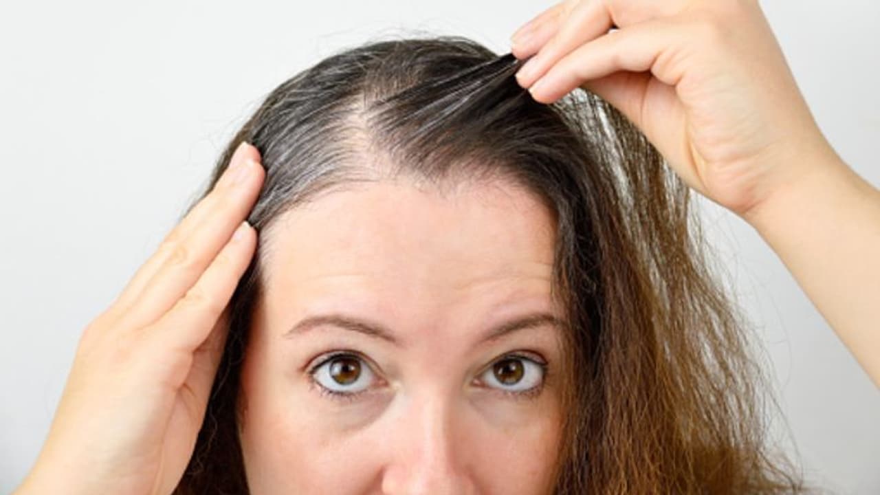 അകാലനര അകറ്റാം; ഡയറ്റില് ഉള്പ്പെടുത്താം ഈ ഭക്ഷണങ്ങള്... അകാലനര അകറ്റാം; ഡയറ്റില് ഉള്പ്പെടുത്താം ഈ ഭക്ഷണങ്ങള്...