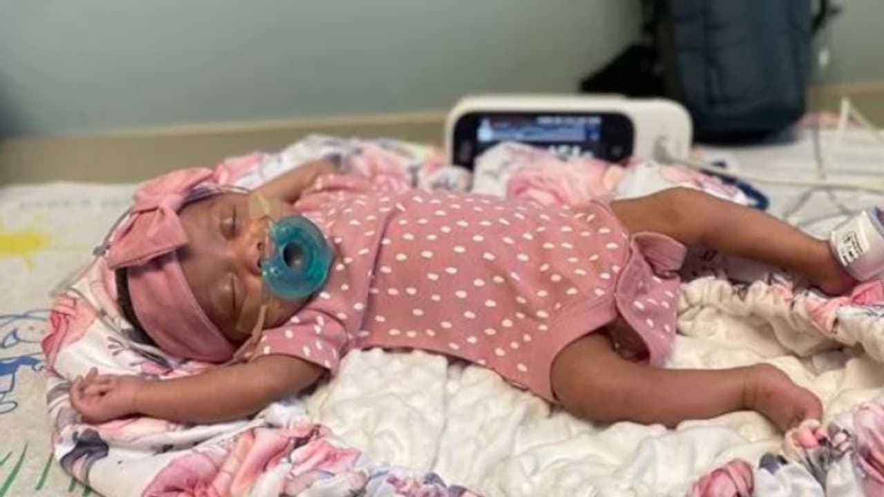 ജനിക്കുന്നതിന് മുമ്പ് കുഞ്ഞിന് മസ്തിഷ്കത്തിൽ ശസ്ത്രക്രിയ; കാരണം അപൂർവ അവസ്ഥ, വിജയം!