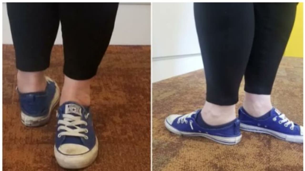 'തലതിരിഞ്ഞവളല്ലിവള്, കാല് തിരിഞ്ഞവള്'; 180 ഡിഗ്രിയില് കാല്പാദം തിരിച്ച് യുവതി, ലോക റിക്കോര്ഡ് 'തലതിരിഞ്ഞവളല്ലിവള്, കാല് തിരിഞ്ഞവള്'; 180 ഡിഗ്രിയില് കാല്പാദം തിരിച്ച് യുവതി, ലോക റിക്കോര്ഡ്