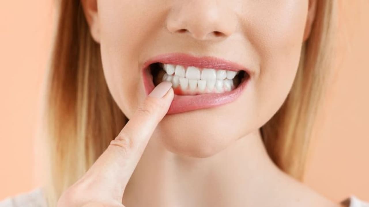 Health Tips: മോണരോഗത്തെ നിസാരമായി കാണരുത്; ശ്രദ്ധിക്കേണ്ട കാര്യങ്ങള്... Health Tips: മോണരോഗത്തെ നിസാരമായി കാണരുത്; ശ്രദ്ധിക്കേണ്ട കാര്യങ്ങള്...