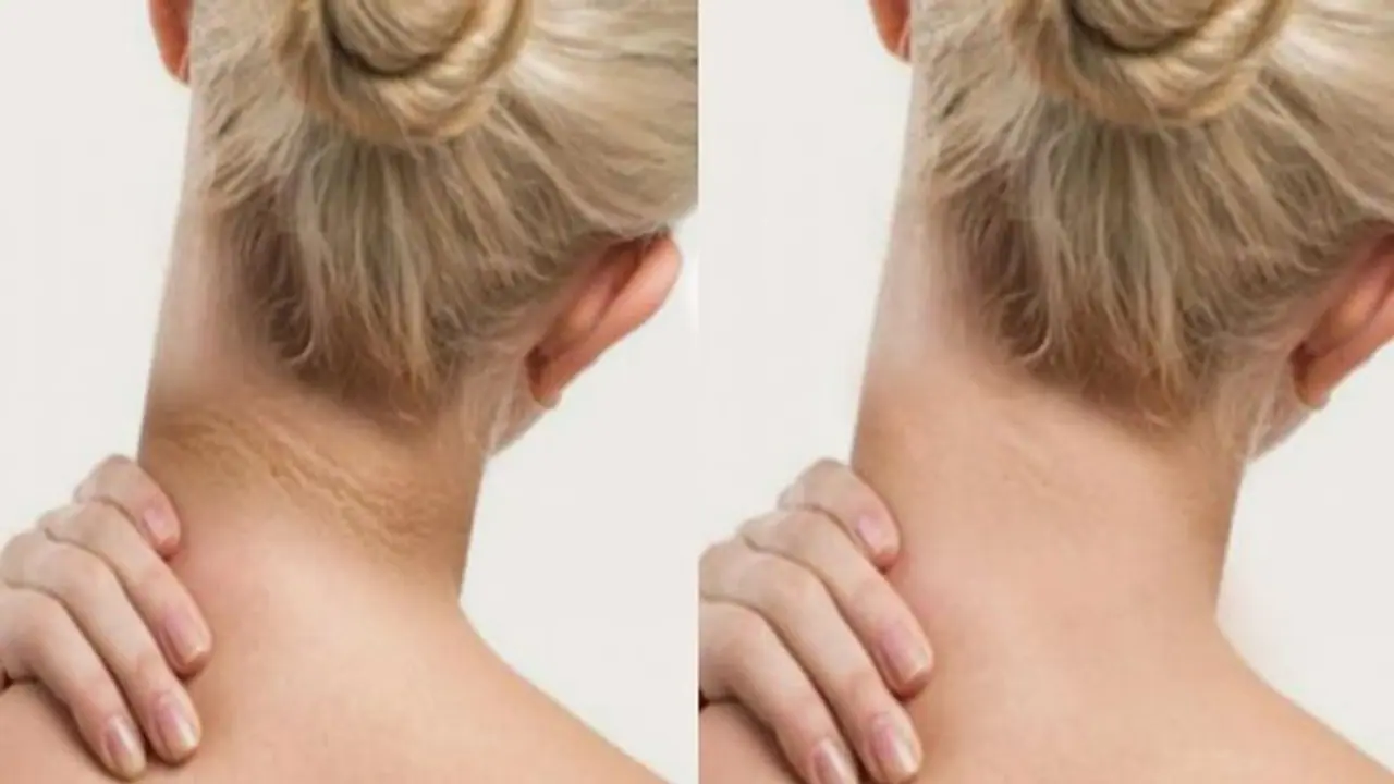 കഴുത്തിന് ചുറ്റുമുള്ള കറുപ്പ് നിറം അകറ്റാം; പരീക്ഷിക്കാം ഈ പാക്കുകള്... കഴുത്തിന് ചുറ്റുമുള്ള കറുപ്പ് നിറം അകറ്റാം; പരീക്ഷിക്കാം ഈ പാക്കുകള്...