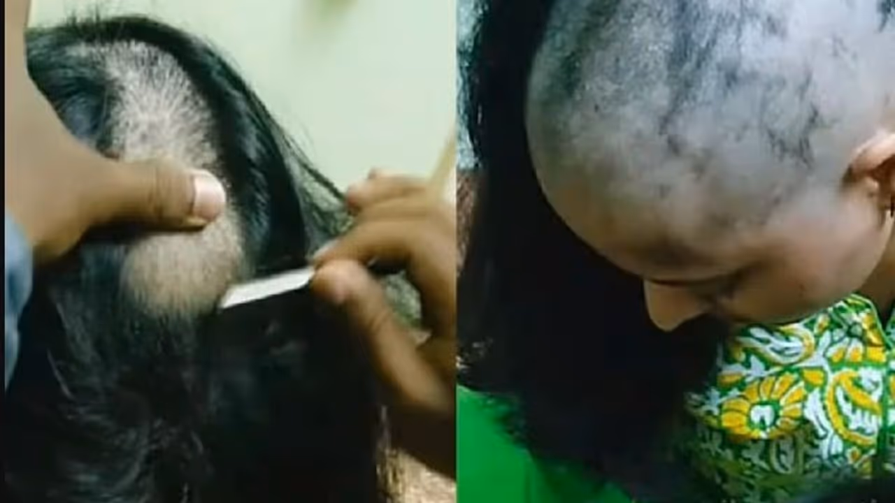 ಮದುವೆಗೆ ಒಪ್ಪದ ಹೆಣ್ಣಿನ ತಲೆ ಬೋಳಿಸಿ ಚಪ್ಪಲಿ ಹಾರ ಹಾಕಿ ಮೆರವಣಿಗೆ ನಡೆಸಿದ ಜನ 