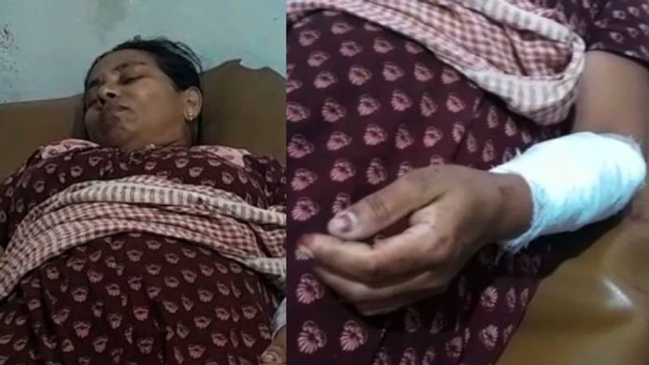 കണ്ണൂരിൽ കാട്ടുപന്നിയുടെ ആക്രമണത്തിൽ വീട്ടമ്മയ്ക്ക് പരിക്ക് കണ്ണൂരിൽ കാട്ടുപന്നിയുടെ ആക്രമണത്തിൽ വീട്ടമ്മയ്ക്ക് പരിക്ക്