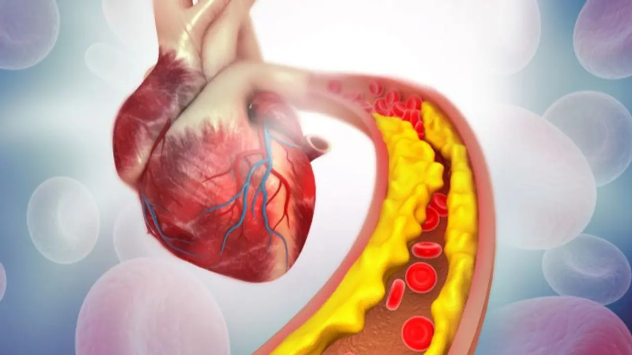 ഉയർന്ന കൊളസ്ട്രോൾ കുറയ്ക്കാൻ ഇതാ ഏഴ് സിമ്പിള്‍ ടിപ്സ്...