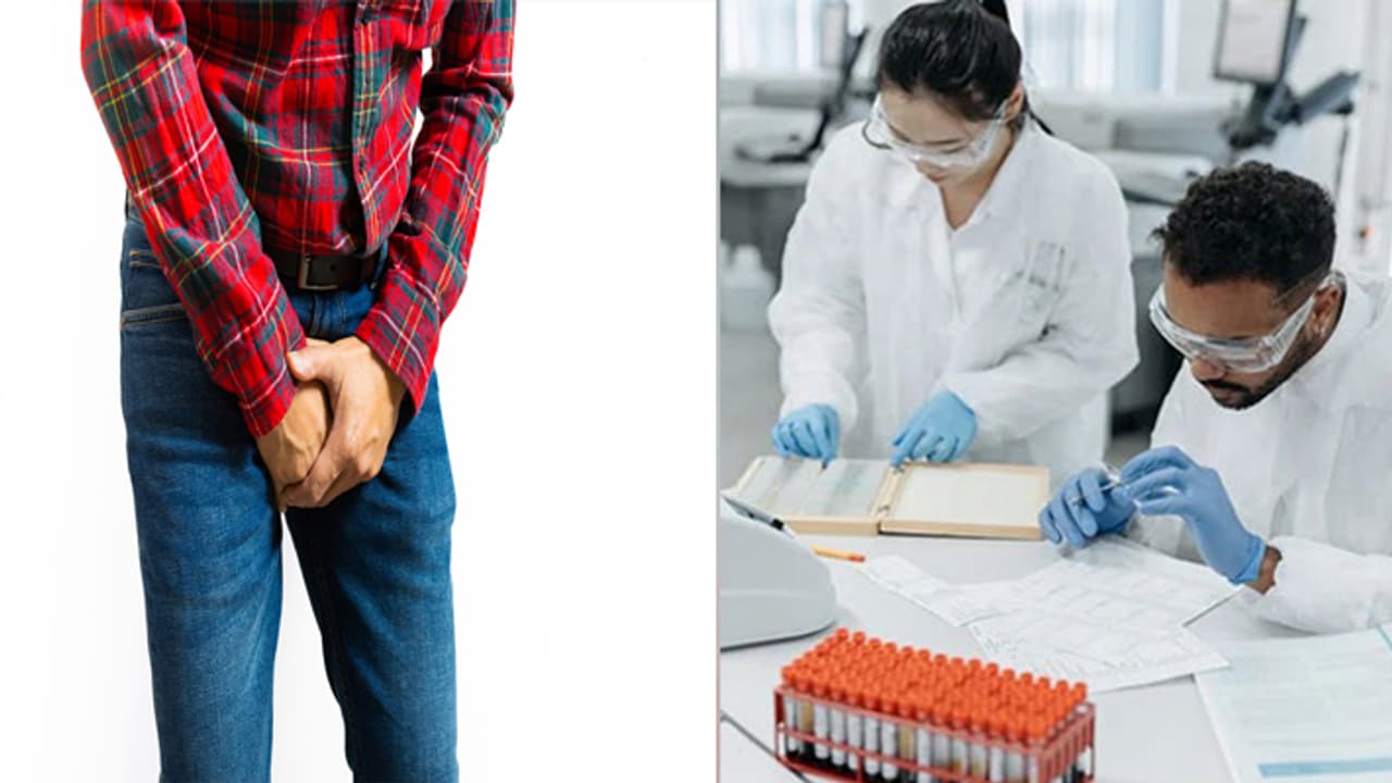 prostate cancer prostate cancer