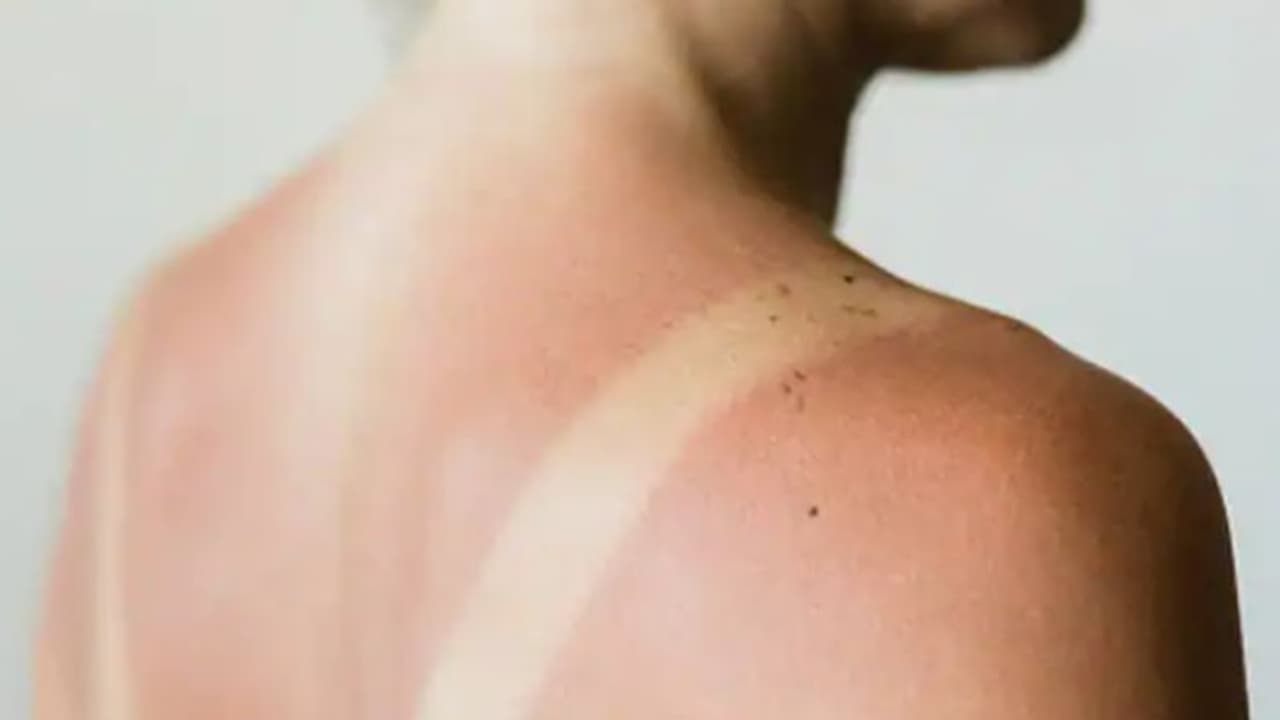 Health Tips: സൂര്യാഘാതം; ലക്ഷണങ്ങള് എന്തെല്ലാം? ശ്രദ്ധിക്കേണ്ട കാര്യങ്ങള്... Health Tips: സൂര്യാഘാതം; ലക്ഷണങ്ങള് എന്തെല്ലാം? ശ്രദ്ധിക്കേണ്ട കാര്യങ്ങള്...