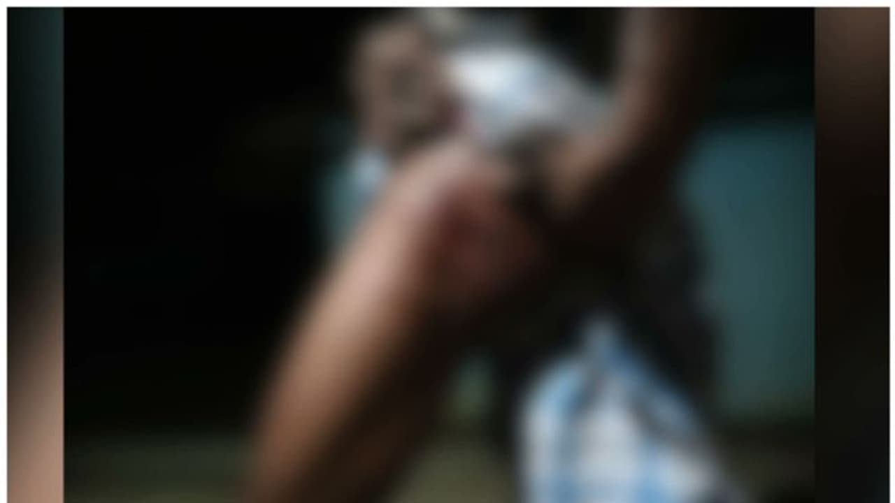 മലപ്പുറത്ത് കരടിയുടെ ആക്രമണത്തിൽ ആദിവാസി യുവാവിന് പരിക്ക്; തൃശൂരിൽ കാട്ടുപന്നി സ്കൂട്ടർ ഇടിച്ചിട്ടു