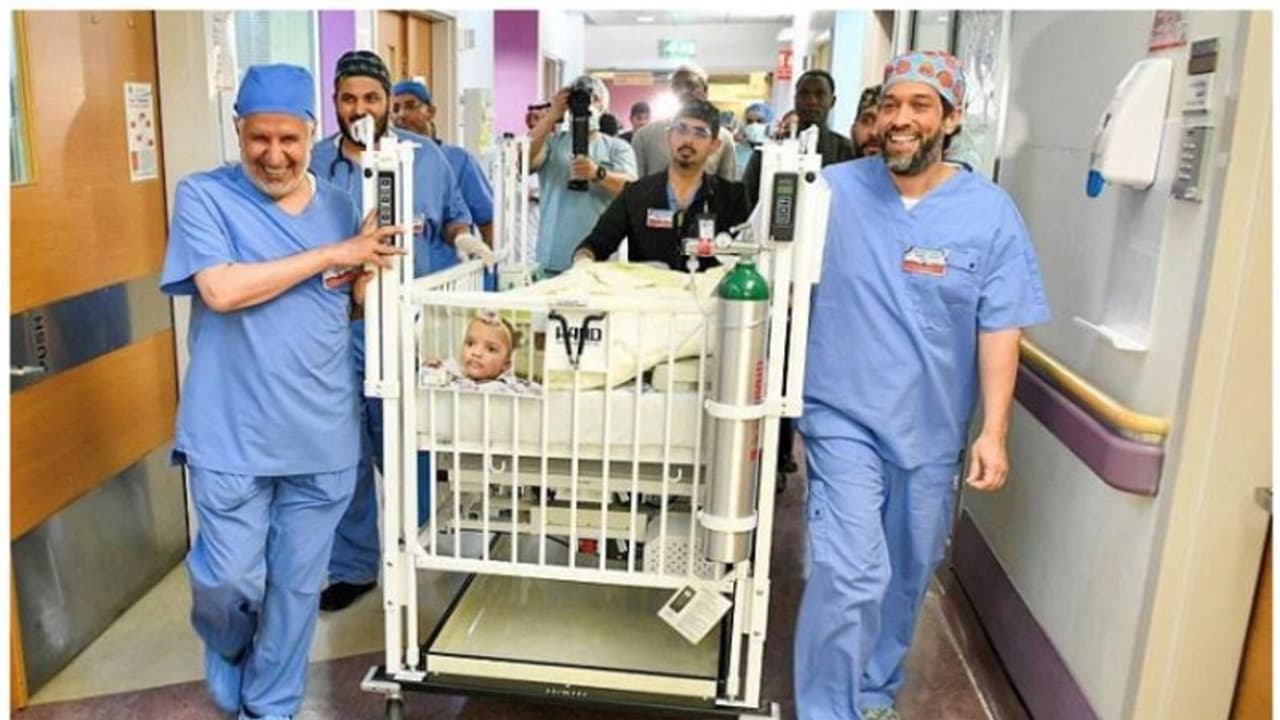 14 മണിക്കൂര്‍ നീണ്ട ശസ്‍ത്രക്രിയ വിജയം; ഹസ്സാനയ്ക്കും ഹാസിനയ്ക്കും ഇനി വെവ്വേറെ ഉറങ്ങാം