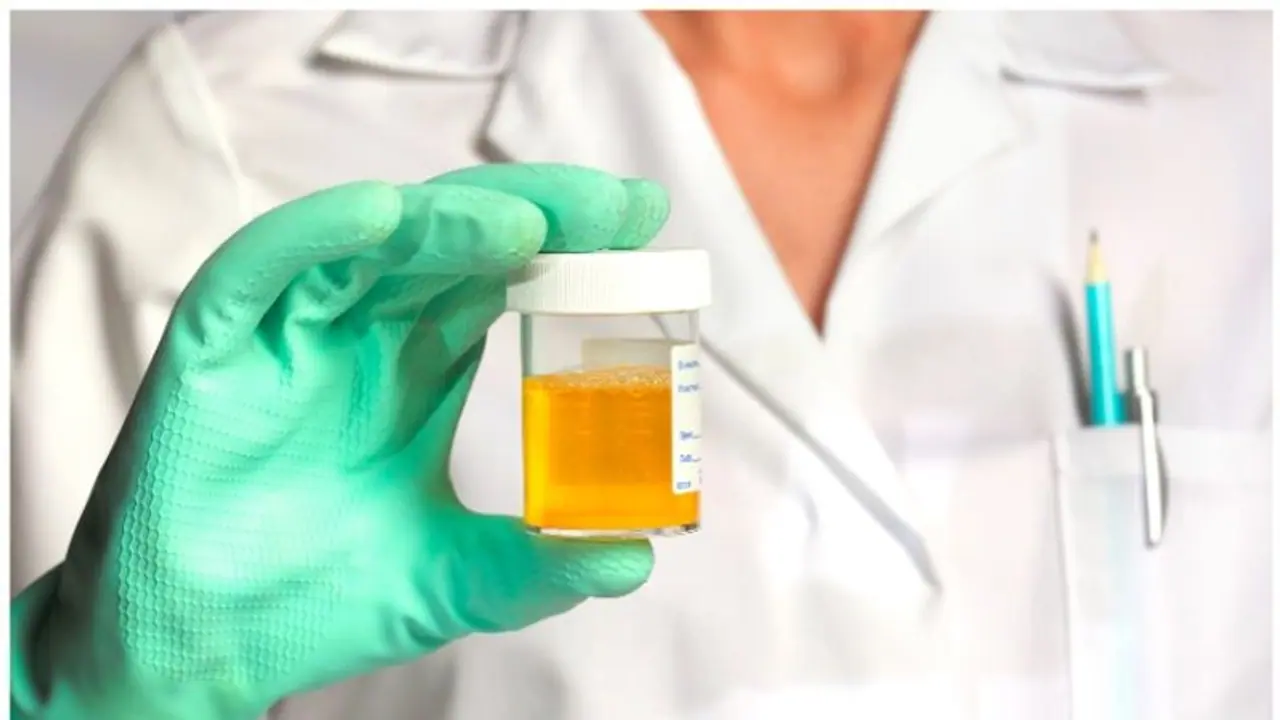 മൂത്രത്തിന് കടും മഞ്ഞ നിറമാണോ? ഇക്കാര്യങ്ങൾ അറിഞ്ഞിരിക്കൂ മൂത്രത്തിന് കടും മഞ്ഞ നിറമാണോ? ഇക്കാര്യങ്ങൾ അറിഞ്ഞിരിക്കൂ