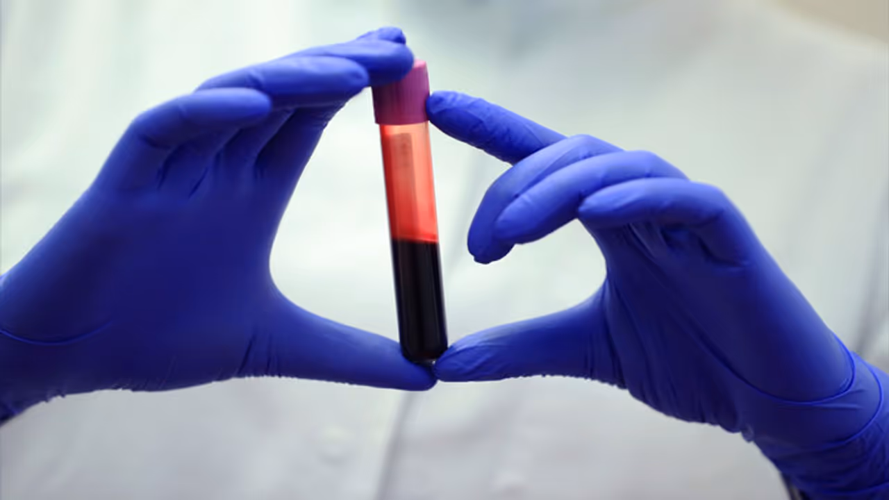 hemoglobin hemoglobin