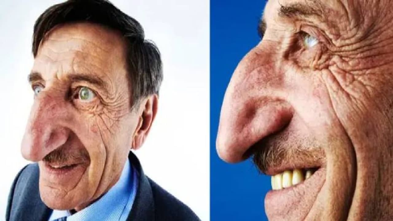 നീളമുള്ള മൂക്ക് കൊണ്ട് ലോകമാകെ അറിയപ്പെട്ട ടർക്കിഷ് പൗരൻ ഓർമ്മയായി