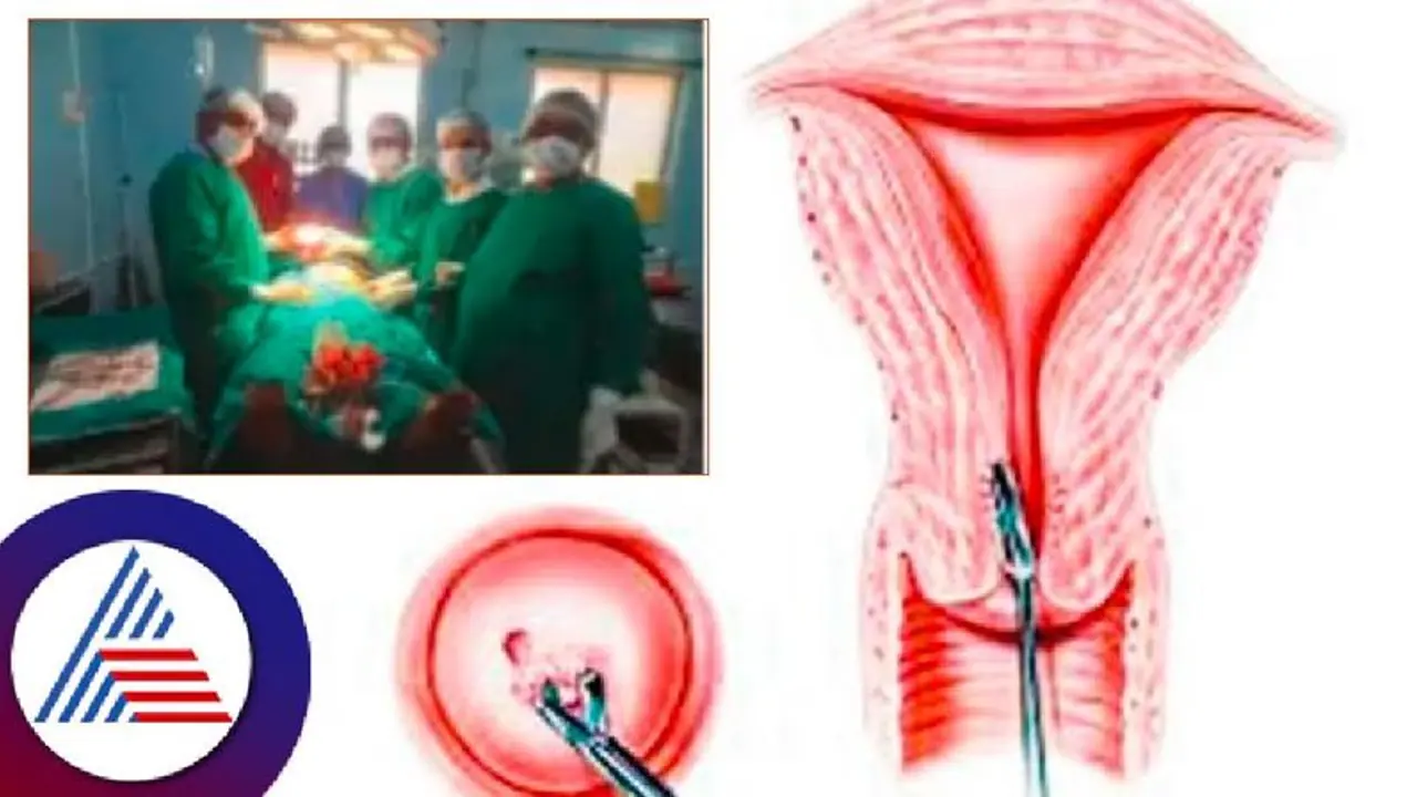 ಬೆಳಗಾವಿ: ಗರ್ಭಕೋಶದಲ್ಲಿ 2.5 ಕೆಜಿ ಗಡ್ಡೆ ಪತ್ತೆ; ಶಸ್ತ್ರ ಚಿಕಿತ್ಸೆ ಯಶಸ್ವಿ