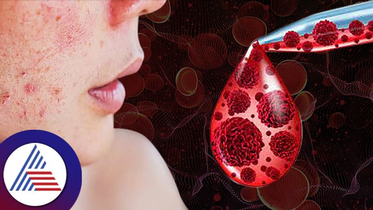 ಡೇಂಜರಸ್ ಬ್ಲಡ್ ಕ್ಯಾನ್ಸರ್ನಲ್ಲಿದೆ ಹಲವು ವಿಧ, ರೋಗಲಕ್ಷಣಗಳ ಬಗ್ಗೆ ಗೊತ್ತಿರ್ಲಿ ಡೇಂಜರಸ್ ಬ್ಲಡ್ ಕ್ಯಾನ್ಸರ್ನಲ್ಲಿದೆ ಹಲವು ವಿಧ, ರೋಗಲಕ್ಷಣಗಳ ಬಗ್ಗೆ ಗೊತ್ತಿರ್ಲಿ