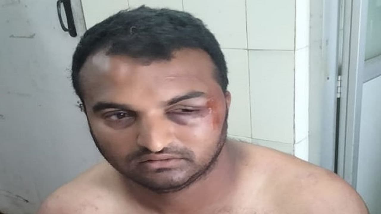 ಚಿಕ್ಕಮಗಳೂರು: ಅನ್ಯಕೋಮಿನ ಮಹಿಳೆಯ ಮನೆಯಲ್ಲಿ ಸಿಕ್ಕಿಬಿದ್ದ ಯುವಕನ ಮೇಲೆ ಮಾರಣಾಂತಿಕ ಹಲ್ಲೆ 