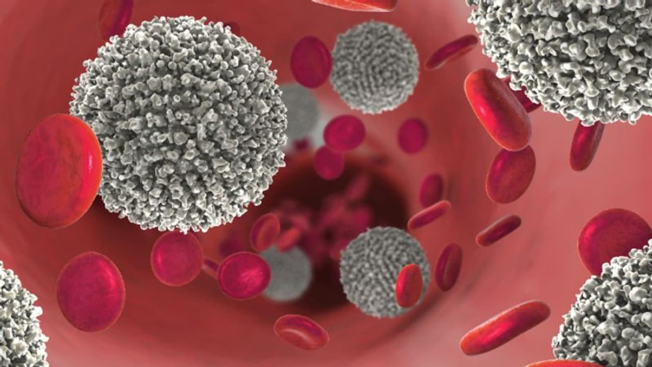 ബ്ലഡ് ക്യാൻസർ; ഈ ലക്ഷണങ്ങൾ നിസാരമാക്കരുത്... ബ്ലഡ് ക്യാൻസർ; ഈ ലക്ഷണങ്ങൾ നിസാരമാക്കരുത്...