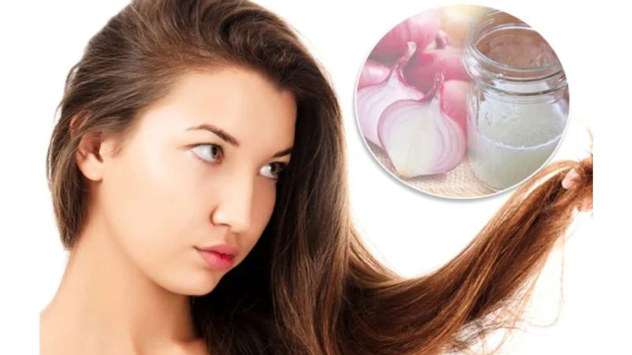 തലമുടി കൊഴിച്ചിലും താരനും അകറ്റാന്‍ പരീക്ഷിക്കാം ഉള്ളി കൊണ്ടുള്ള പൊടിക്കൈകള്‍...