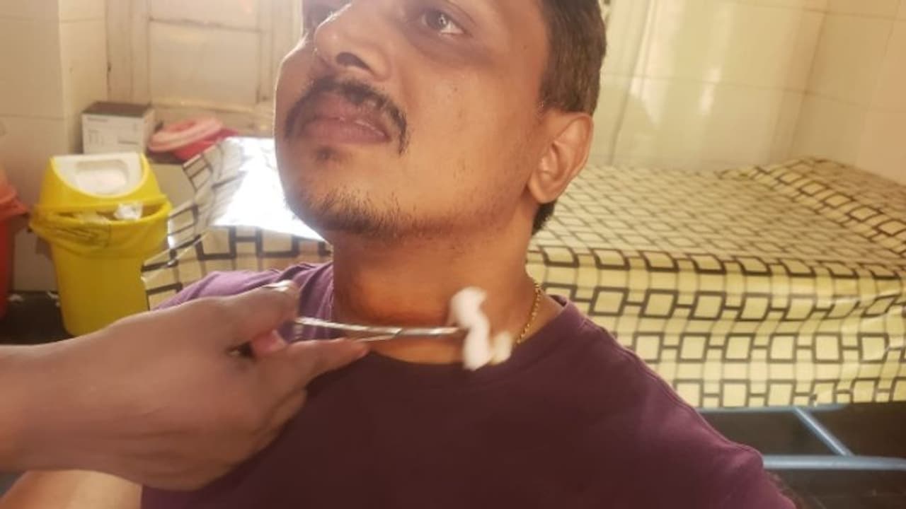 വീണ്ടും കേബിൾ അപകടം: ബൈക്കിൽ പോയ യുവാവിന്റെ കഴുത്തിൽ കുടുങ്ങി, പരിക്ക് വീണ്ടും കേബിൾ അപകടം: ബൈക്കിൽ പോയ യുവാവിന്റെ കഴുത്തിൽ കുടുങ്ങി, പരിക്ക്