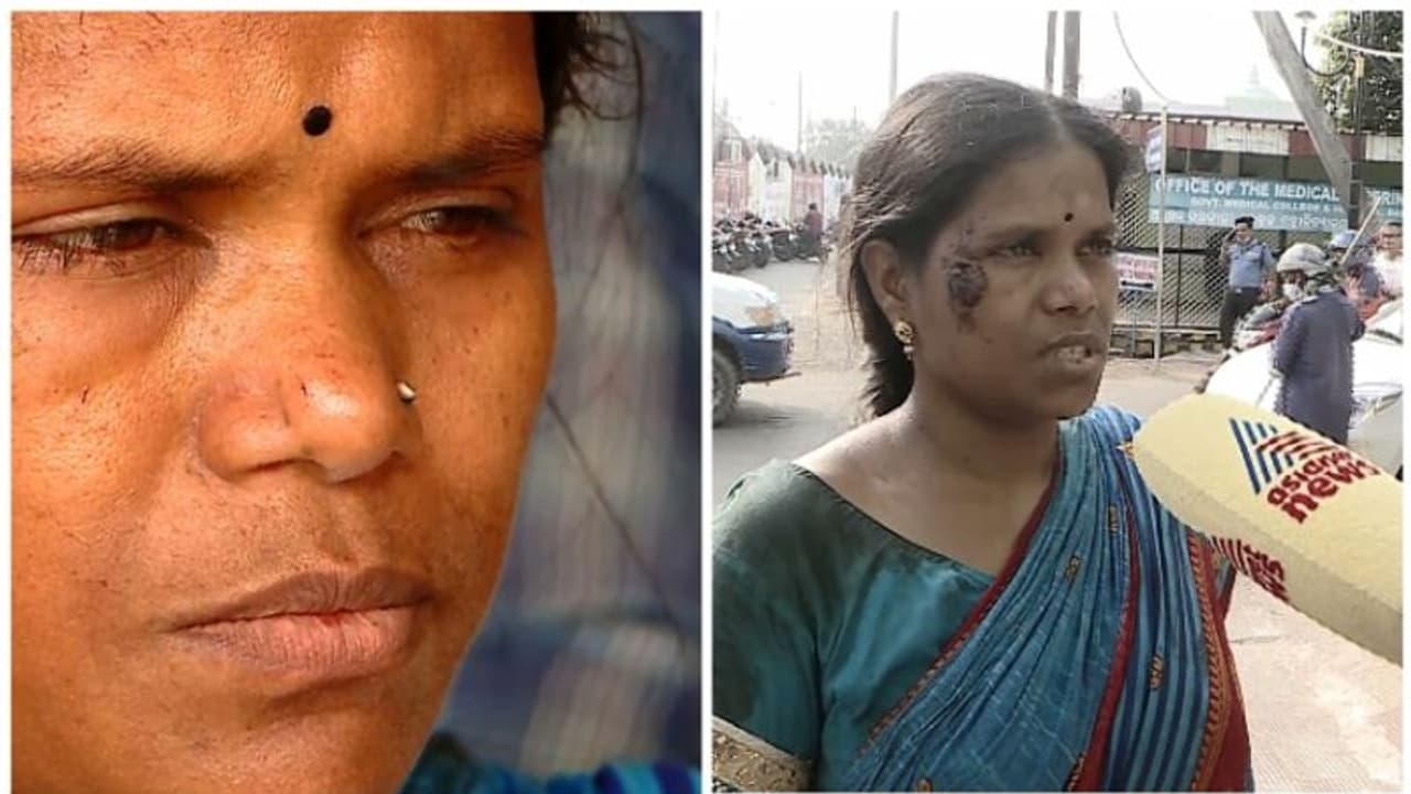 പത്തു വയസുകാരൻ മകനെയും സഹോദരനെയും തേടി ആശുപത്രികൾ കയറിയിറങ്ങുന്ന ഒരു അമ്മ, തീരാനോവായി അർച്ചന പത്തു വയസുകാരൻ മകനെയും സഹോദരനെയും തേടി ആശുപത്രികൾ കയറിയിറങ്ങുന്ന ഒരു അമ്മ, തീരാനോവായി അർച്ചന