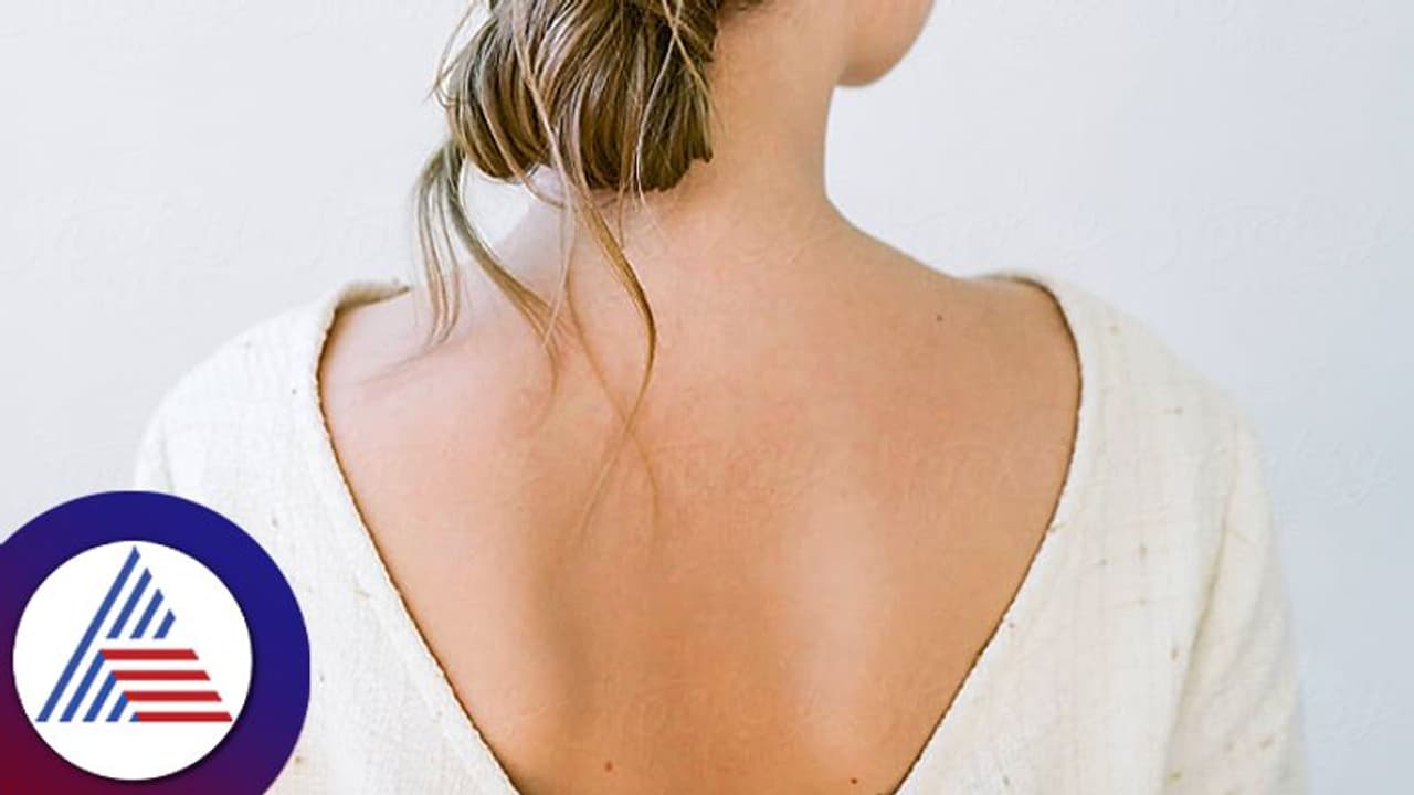 Beauty Tips: ಕಪ್ಪಾದ ಬೆನ್ನಿಗೆ ಮನೆಯಲ್ಲೇ ಔಷಧ Beauty Tips: ಕಪ್ಪಾದ ಬೆನ್ನಿಗೆ ಮನೆಯಲ್ಲೇ ಔಷಧ