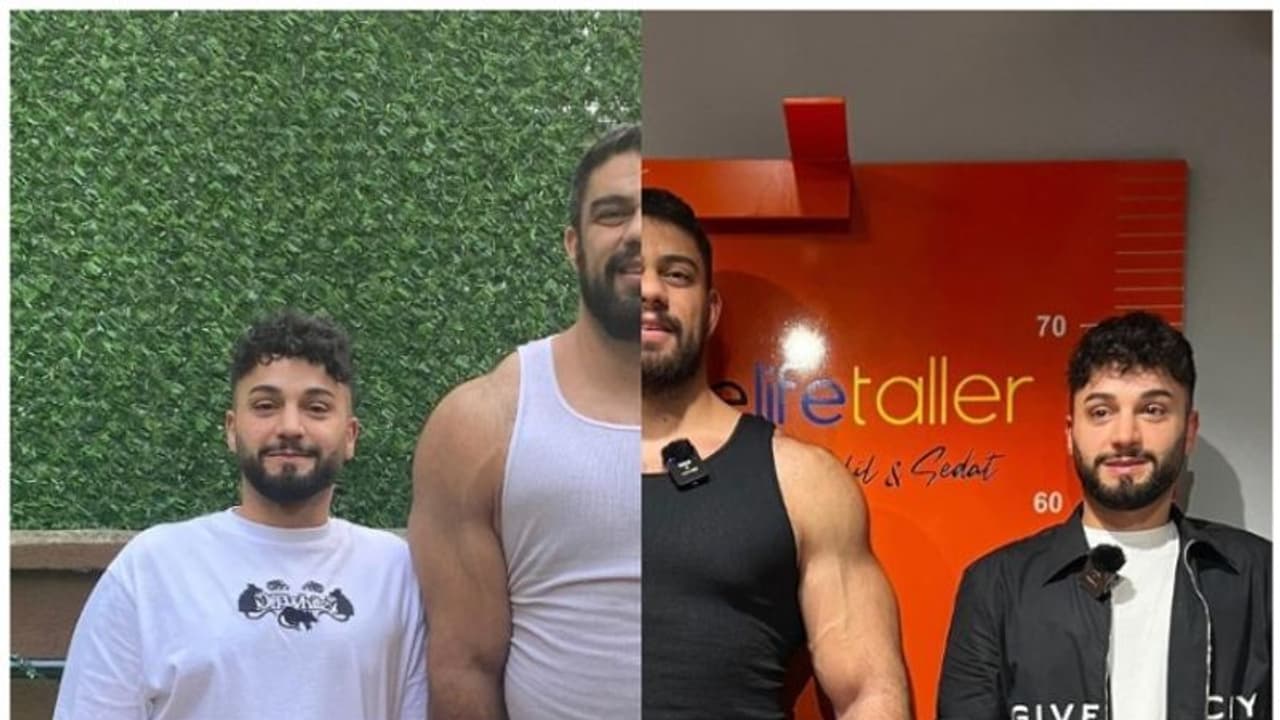 ആറടി ഉയരമുള്ളയാള് വീണ്ടും ഏഴ് ഇഞ്ച് കൂട്ടാനായി ചെലവഴിക്കുന്നത് 88 ലക്ഷം ! ആറടി ഉയരമുള്ളയാള് വീണ്ടും ഏഴ് ഇഞ്ച് കൂട്ടാനായി ചെലവഴിക്കുന്നത് 88 ലക്ഷം !