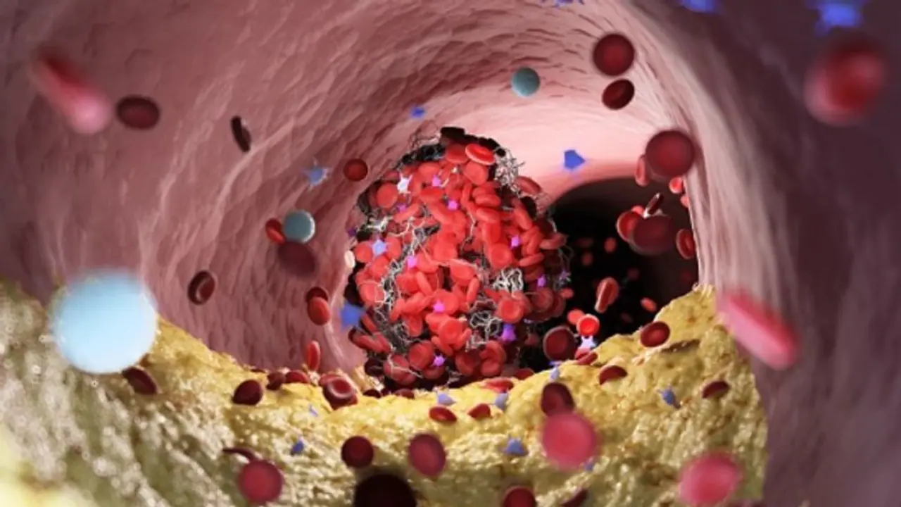 കൊളസ്ട്രോളിനെ കുറയ്ക്കാന്‍ സഹായിക്കും പതിവായി കഴിക്കുന്ന ഈ ഭക്ഷണങ്ങള്‍... 