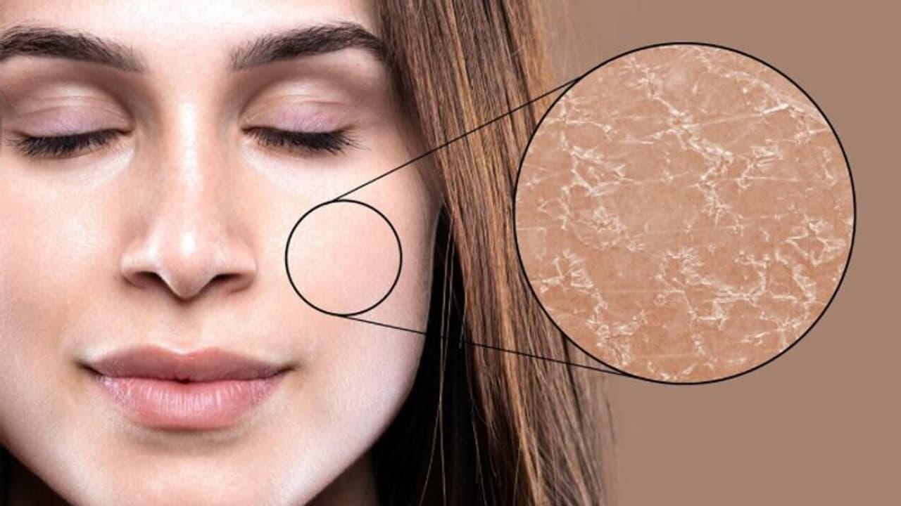 വരണ്ട ചര്മ്മമുള്ളവര് കഴിക്കേണ്ട പതിനഞ്ച് ഭക്ഷണങ്ങള്... വരണ്ട ചര്മ്മമുള്ളവര് കഴിക്കേണ്ട പതിനഞ്ച് ഭക്ഷണങ്ങള്...