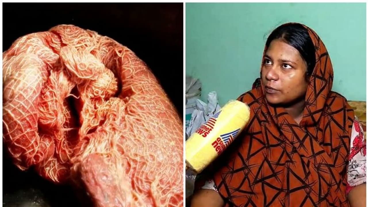 പ്രസവ ശസ്ത്രക്രിയക്കിടെ വയറ്റില് പഞ്ഞി മറന്നുവച്ചെന്ന് പരാതി; പാലക്കാട് പാലന ആശുപത്രിക്കെതിരെ കേസെടുത്തു പ്രസവ ശസ്ത്രക്രിയക്കിടെ വയറ്റില് പഞ്ഞി മറന്നുവച്ചെന്ന് പരാതി; പാലക്കാട് പാലന ആശുപത്രിക്കെതിരെ കേസെടുത്തു